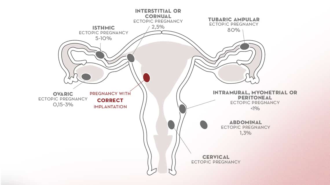 Endometrium Thickness in Pregnancy: Symptoms & Treatment