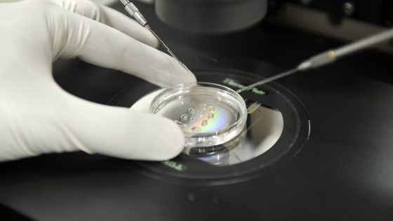 Das Instituto Bernabeu erforscht, welche Faktoren können den Erfolg eines Embryonentransfers beeinflussen können