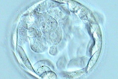 Das Instituto Bernabeu bestätigen, dass die Veränderung von Zellen des Embryos, die durch Massive DNA-Sequenzierung entdeckt werden, die Geburtenrate nicht beeinträchtigt