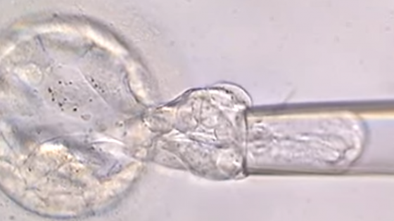 Das Instituto Bernabeu erforscht, ob es eine Zunahme der Zwillingsschwangerschaften nach Durchführung einer Biopsie beim Embryo gibt