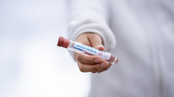 Die Erkennungstests von Coronavirus covid-19  werden in unseren Schwangerschaftsgarantieprogrammen kostenlos inbegriffen sein