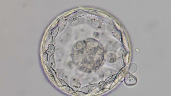 Research carried out by Instituto Bernabeu addresses different types of ovarian stimulation for IVF and their impact on chromosomal abnormalities in the embryo