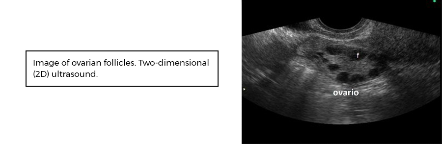 Size of mature follicle ready for ovulation