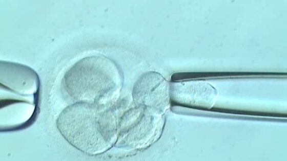 Forschung am IB: Beeinträchtigt die Blastocystenbiopsie das Implantationspotenzial von gefrorenen/aufgetauten chromosomisch normalen Embryonen?