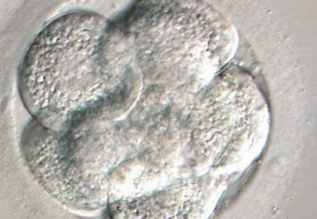 Forschung Instituto Bernabeu: Chromosomenstudie von Embryonen die sich am dritten Tag der schneller entwickeln.