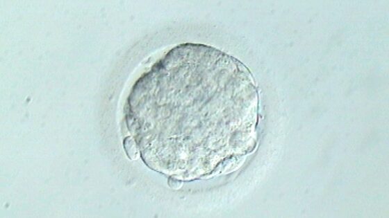 Embryonen mit genetischen Störungen bewahren die Fähigkeit, die Schwangerschaft zu erzielen. Klinische Studie am IB. ESHRE 2016