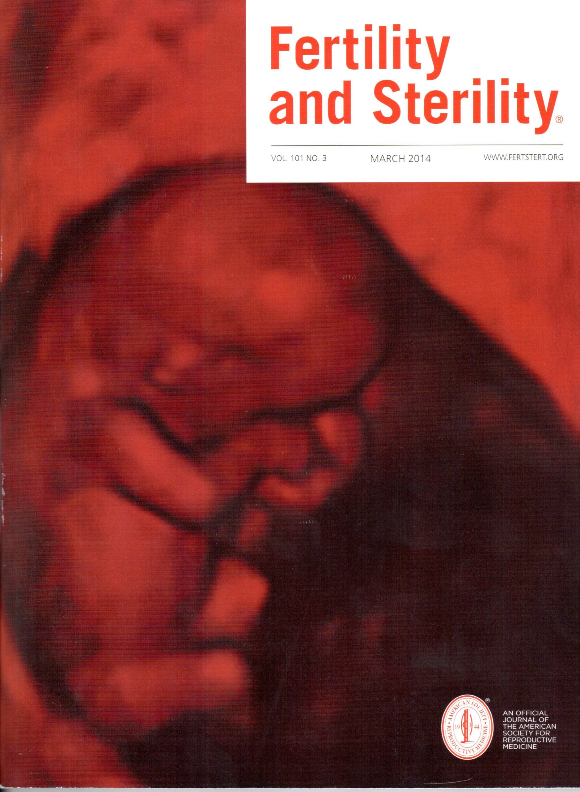 Publicación En La Revista “Fertility And Sterility”